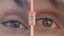 Suchá pokožká na očním víčkem - foto "před a po" používání balzámu DermaFood